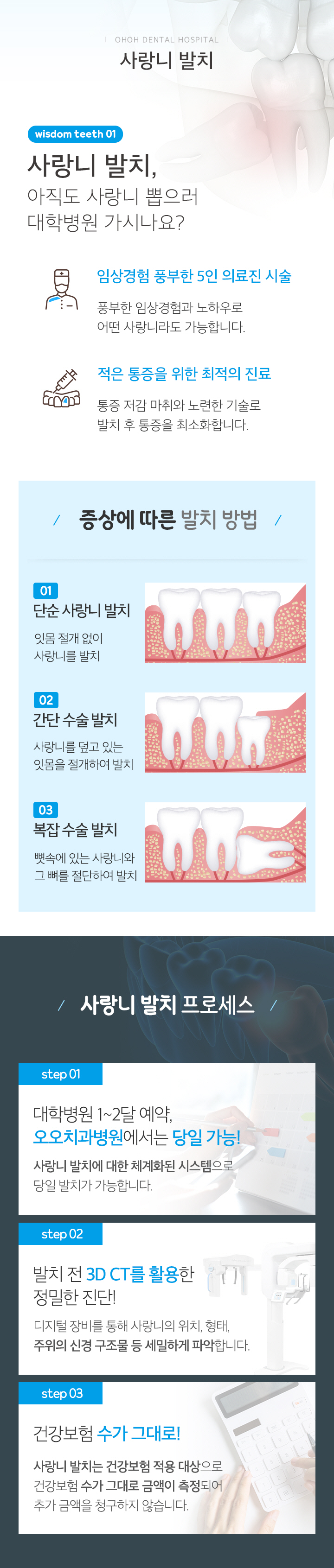 사랑니 발치